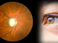 Глаукома: в чем опасность?